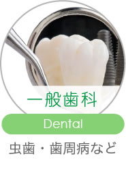 一般歯科 Dental 虫歯・歯周病など